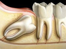 cirurgia