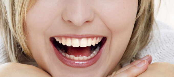 Avulsão (quando o dente sai por inteiro após um acidente) Avulsão (quando o dente sai por inteiro após um acidente)