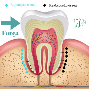 Força x reabsorção